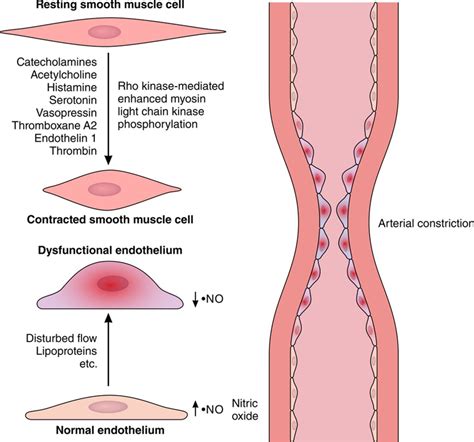 Acute Coronary Syndromes Circulation