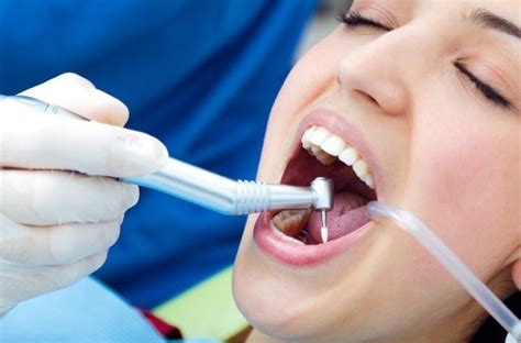 5 Major Benefits Of Dental Cleaning And Scaling Procedure