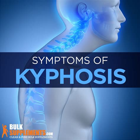 Kyphosis Symptoms Causes And Treatment By James Denlinger Medium