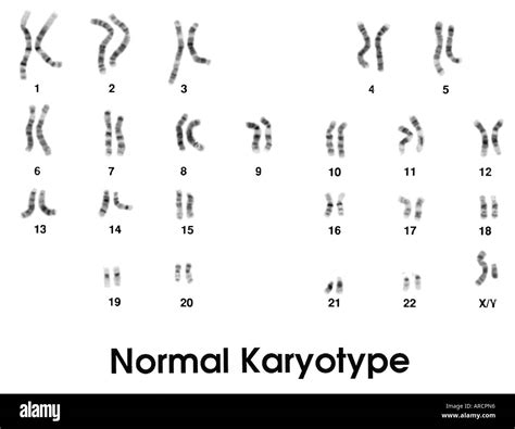 Cromosomas Masculinos Normales Fotografías E Imágenes De Alta