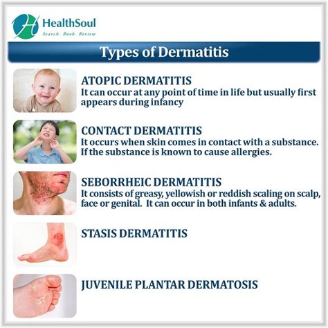 Dermatitis Definition Types Causes Symptoms And Treatment Images And