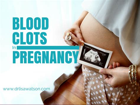 Not recommended under 6 years of age unless properly diagnosed. Blood Clots in Pregnancy | Dr. Lisa Watson
