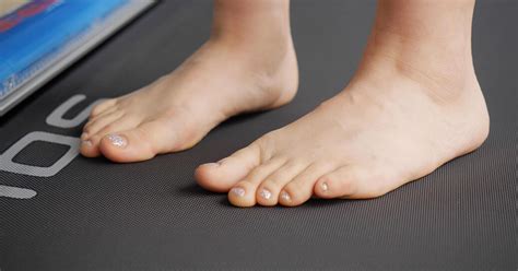 Foot Doctor In Singapore For Curly Toe Syndrome
