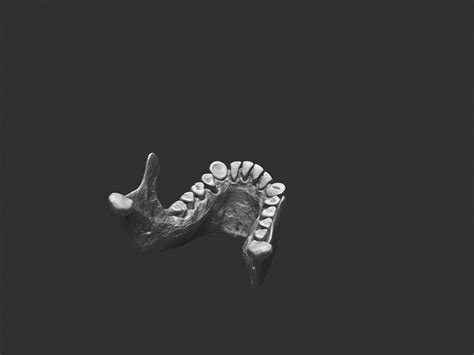 Homo Erectus Dmanisi Skull 3d Print Model By Rbonnacoelho