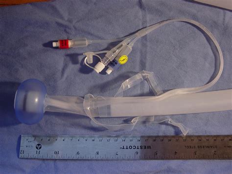 Balloon Compression As Treatment For Refractory Vaginal Hemorrhage Annals Of Emergency Medicine