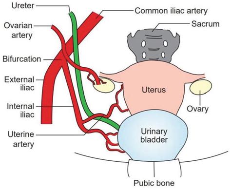 Ureteric Injury In Gynecology Surgery Intechopen