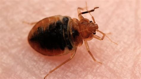 Heres How To Treat Bed Bug Bites