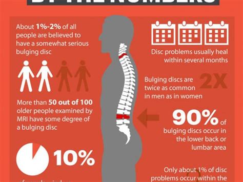 Walking, sitting, standing…all of your movements can be affected. Disc Bulge Treatment options in Shakopee, MN. | Shakopee ...