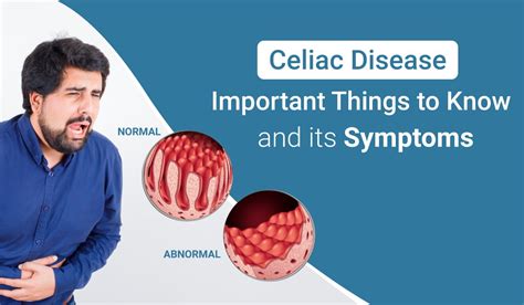 Celiac Disease Important Things To Know And Its Symptoms