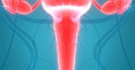 Cervicitis Symptoms Causes Treatments And Natural Remedies