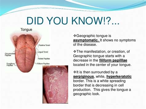 herpes on tongue pics pictures photos