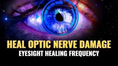 Eyesight Healing Frequency Heal Optic Nerve Damage Get Relief From