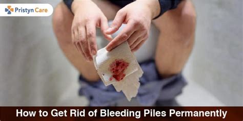 how to get rid of bleeding piles permanently pristyn care