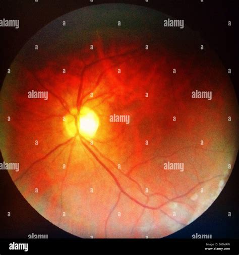 The Inside Of An Eyeball Stock Photo Alamy