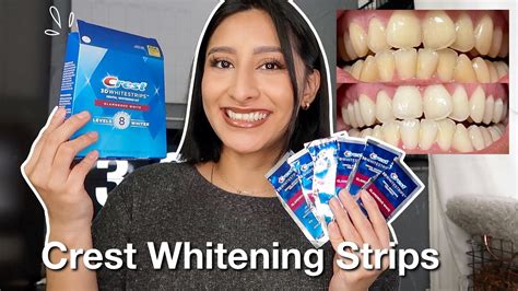 🐈 Crest White Strips Results Pictures Updated Top 10 Best Crest