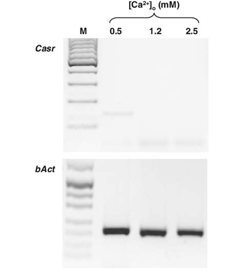 Pth C1 Genes Expression Analysis Casr 139 Bp Bact 201 Bp With Download Scientific