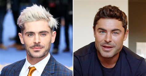 Did Zac Efron Get Work Done On His Face Plastic Surgeons Weigh In