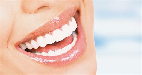 Teeth Whitening Is A Great Way To Achieve A Sparkling Smile