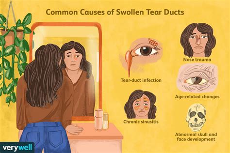 Swollen Tear Duct Causes And Treatment 2022