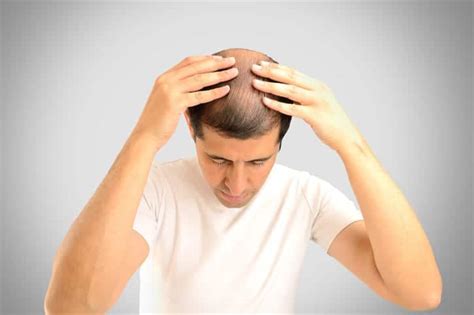 Hair loss is never the only symptom of anxiety. The Connection Between Anxiety and Hair Loss - Erick Solms ...