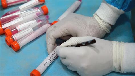 The requirement for prolific testing is increasing with time. Bihar caps cost of Covid RT-PCR test at Rs 800, down from ...
