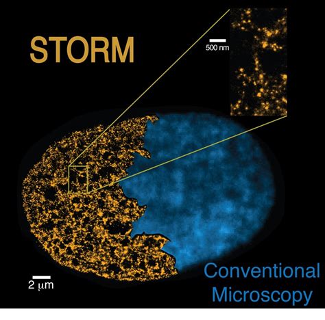 Super Resolution Microscopes Reveal The Link Between Genome Packaging