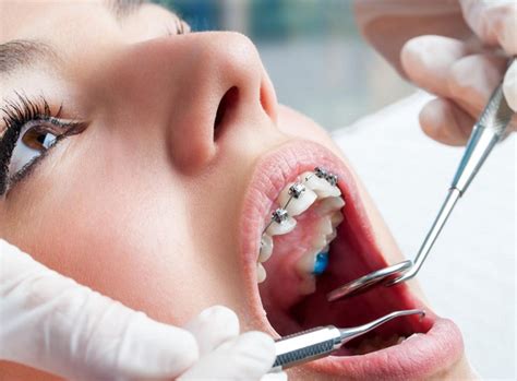 these 5 reasons are more responsible for tooth sensitivity best orthodontist melbourne