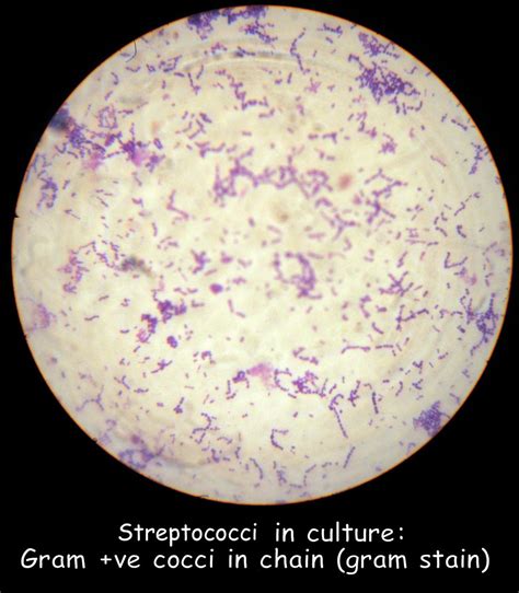 Streptococci In Culture Gram Ve Cocci In Chain Albaraa Mehdar Flickr