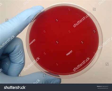 Blood Agar Images Stock Photos And Vectors Shutterstock