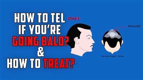 If it is in fact male pattern baldness, there should be some slight thinning or. How to tell If You're going bald & How to treat hair loss ...