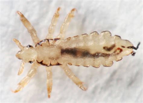 Pediculosis capitis, pubis & corporis symptoms, diagnosis ...