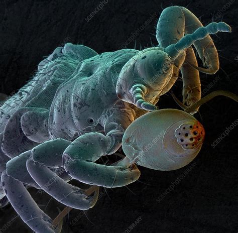 Human Head Louse With Egg Stock Image Z2650085 Science Photo Library