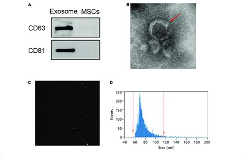 Extraction And Identification Of Uc Msc Exo A Expression Of