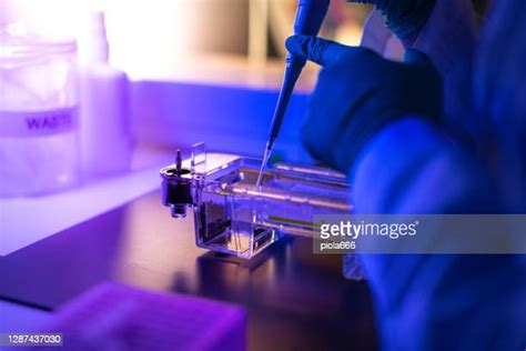 Dna Agarose Gel Photos And Premium High Res Pictures Getty Images