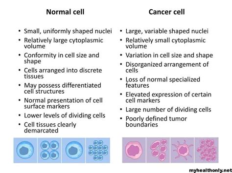 Cancer Cells How Would It Happen And Spread My Health Only