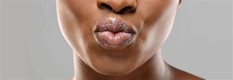 Dry Lip Causes And Dry Lip Treatments Unilever Vaseline®