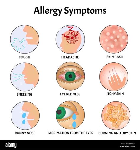 Symptoms Of Allergies Skin Rash Allergic Skin Itching Tearing From The Eyes Cough Sneezing