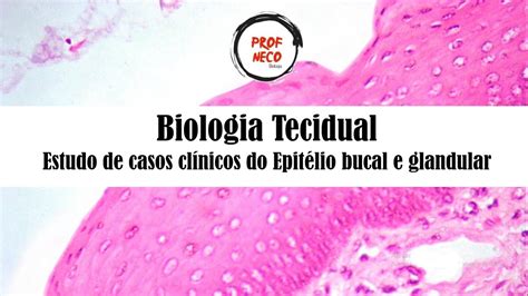 Biologia Tecidual Para Odontologia Casos Clínicos Do Tecido Epitelial
