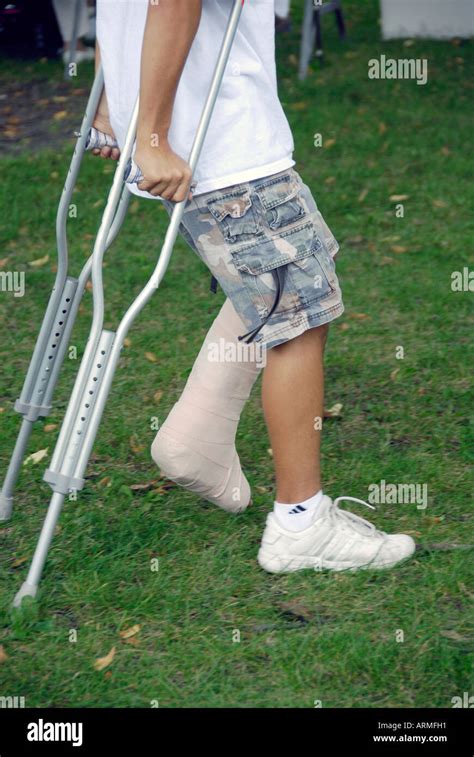 Boy With Injured Ankle Walking On Crutches Stock Photo Alamy