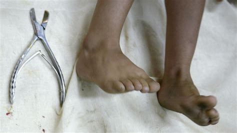German Court Rules Religious Circumcision Of Minors Is Assault