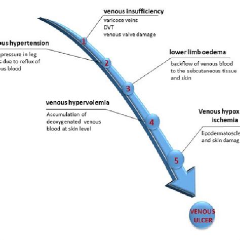 Chronic Venous Insufficiency Process Download Scientific Diagram