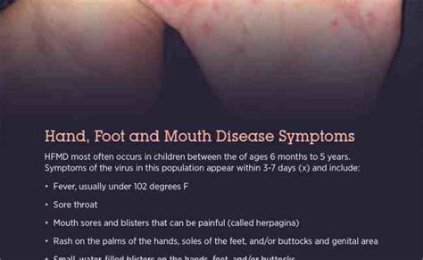hand foot and mouth disease hfmd symptoms causes treatment otosection