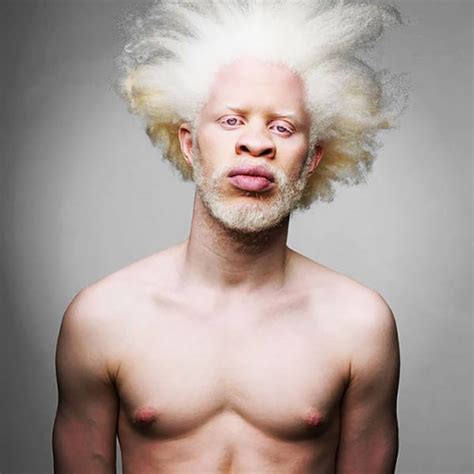 These Beautiful Albino People Are Simply Breathtaking Pics Izismile Com