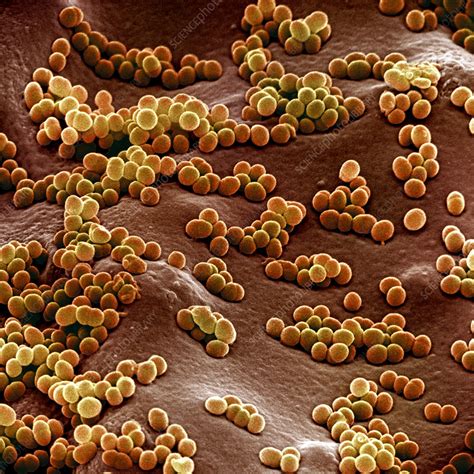 Staphylococcus Aureus Stock Image C Science Photo Library