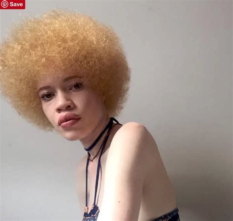 Diandra Forrest Is The First Female Albino African American Model To