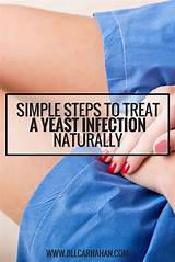 Holistic Cure For Genital Herpes