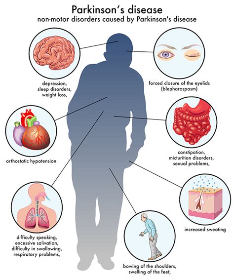 We did not find results for: Parkinsons Disease - German Neuroscience Center Dubai
