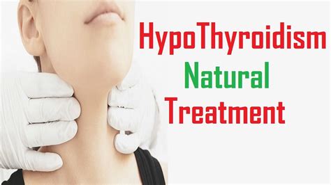 15 Best Remedies For Hypothyroidism Treatment Youtube