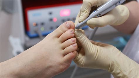 Facts About Podiatrists You Need To Know District Foot Ankle