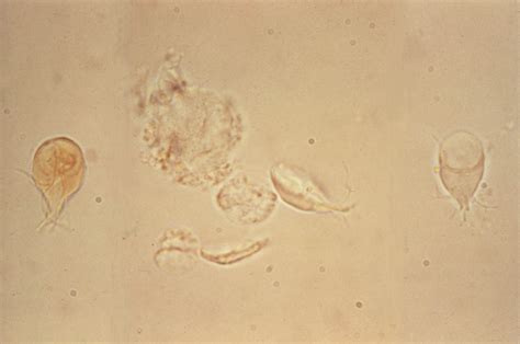 Microscope Giardia Lamblia Trophozoite Micropedia
